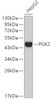 Western blot analysis of extracts of HepG2 cells, using PGK2 antibody (19-248) .<br/>Secondary antibody: HRP Goat Anti-Rabbit IgG (H+L) at 1:10000 dilution.<br/>Lysates/proteins: 25ug per lane.<br/>Blocking buffer: 3% nonfat dry milk in TBST.