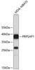 Western blot analysis of extracts of MDA-MB-435 cells, using PRPSAP1 antibody (19-257) .<br/>Secondary antibody: HRP Goat Anti-Rabbit IgG (H+L) at 1:10000 dilution.<br/>Lysates/proteins: 25ug per lane.<br/>Blocking buffer: 3% nonfat dry milk in TBST.