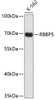 Western blot analysis of extracts of K-562 cells, using RBBP5 antibody (19-267) .<br/>Secondary antibody: HRP Goat Anti-Rabbit IgG (H+L) at 1:10000 dilution.<br/>Lysates/proteins: 25ug per lane.<br/>Blocking buffer: 3% nonfat dry milk in TBST.