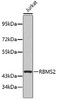 Western blot analysis of extracts of Jurkat cells, using RBMS2 antibody (19-268) .<br/>Secondary antibody: HRP Goat Anti-Rabbit IgG (H+L) at 1:10000 dilution.<br/>Lysates/proteins: 25ug per lane.<br/>Blocking buffer: 3% nonfat dry milk in TBST.