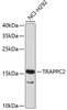 Western blot analysis of extracts of NCI-H292 cells, using TRAPPC2 antibody (19-280) .<br/>Secondary antibody: HRP Goat Anti-Rabbit IgG (H+L) at 1:10000 dilution.<br/>Lysates/proteins: 25ug per lane.<br/>Blocking buffer: 3% nonfat dry milk in TBST.