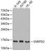 Western blot analysis of extracts of various cell lines, using SNRPD2 antibody (19-285) .<br/>Secondary antibody: HRP Goat Anti-Rabbit IgG (H+L) at 1:10000 dilution.<br/>Lysates/proteins: 25ug per lane.<br/>Blocking buffer: 3% nonfat dry milk in TBST.