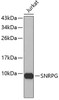 Western blot analysis of extracts of Jurkat cells, using SNRPG antibody (19-286) .<br/>Secondary antibody: HRP Goat Anti-Rabbit IgG (H+L) at 1:10000 dilution.<br/>Lysates/proteins: 25ug per lane.<br/>Blocking buffer: 3% nonfat dry milk in TBST.