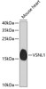 Western blot analysis of extracts of mouse heart, using VSNL1 antibody (19-303) .<br/>Secondary antibody: HRP Goat Anti-Rabbit IgG (H+L) at 1:10000 dilution.<br/>Lysates/proteins: 25ug per lane.<br/>Blocking buffer: 3% nonfat dry milk in TBST.