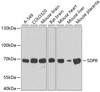Western blot analysis of extracts of various cell lines, using SDPR antibody (19-312) .<br/>Secondary antibody: HRP Goat Anti-Rabbit IgG (H+L) at 1:10000 dilution.<br/>Lysates/proteins: 25ug per lane.<br/>Blocking buffer: 3% nonfat dry milk in TBST.