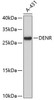 Western blot analysis of extracts of A-431 cells, using DENR antibody (19-314) .<br/>Secondary antibody: HRP Goat Anti-Mouse IgG (H+L) (AS003) at 1:10000 dilution.<br/>Lysates/proteins: 25ug per lane.<br/>Blocking buffer: 3% nonfat dry milk in TBST.