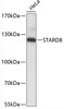 Western blot analysis of extracts of HeLa cells, using STARD8 antibody (19-346) .<br/>Secondary antibody: HRP Goat Anti-Rabbit IgG (H+L) at 1:10000 dilution.<br/>Lysates/proteins: 25ug per lane.<br/>Blocking buffer: 3% nonfat dry milk in TBST.