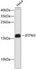 Western blot analysis of extracts of HeLa cells, using IFITM3 antibody (19-361) .<br/>Secondary antibody: HRP Goat Anti-Rabbit IgG (H+L) at 1:10000 dilution.<br/>Lysates/proteins: 25ug per lane.<br/>Blocking buffer: 3% nonfat dry milk in TBST.