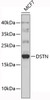 Western blot analysis of extracts of MCF-7 cells, using DSTN antibody (19-391) .<br/>Secondary antibody: HRP Goat Anti-Rabbit IgG (H+L) at 1:10000 dilution.<br/>Lysates/proteins: 25ug per lane.<br/>Blocking buffer: 3% nonfat dry milk in TBST.