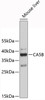 Western blot analysis of extracts of mouse liver, using CA5B antibody (19-395) .<br/>Secondary antibody: HRP Goat Anti-Rabbit IgG (H+L) at 1:10000 dilution.<br/>Lysates/proteins: 25ug per lane.<br/>Blocking buffer: 3% nonfat dry milk in TBST.