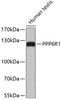 Western blot analysis of extracts of human testis, using PPP6R1 antibody (19-402) .<br/>Secondary antibody: HRP Goat Anti-Rabbit IgG (H+L) at 1:10000 dilution.<br/>Lysates/proteins: 25ug per lane.<br/>Blocking buffer: 3% nonfat dry milk in TBST.