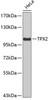 Western blot analysis of extracts of HeLa cells, using TPX2 antibody (19-404) .<br/>Secondary antibody: HRP Goat Anti-Rabbit IgG (H+L) at 1:10000 dilution.<br/>Lysates/proteins: 25ug per lane.<br/>Blocking buffer: 3% nonfat dry milk in TBST.
