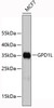 Western blot analysis of extracts of MCF-7 cells, using GPD1L antibody (19-407) .<br/>Secondary antibody: HRP Goat Anti-Rabbit IgG (H+L) at 1:10000 dilution.<br/>Lysates/proteins: 25ug per lane.<br/>Blocking buffer: 3% nonfat dry milk in TBST.