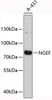 Western blot analysis of extracts of A-431 cells, using NGEF antibody (19-418) .<br/>Secondary antibody: HRP Goat Anti-Rabbit IgG (H+L) at 1:10000 dilution.<br/>Lysates/proteins: 25ug per lane.<br/>Blocking buffer: 3% nonfat dry milk in TBST.