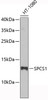 Western blot analysis of extracts of HT-1080 cells, using SPCS1 antibody (19-438) .<br/>Secondary antibody: HRP Goat Anti-Rabbit IgG (H+L) at 1:10000 dilution.<br/>Lysates/proteins: 25ug per lane.<br/>Blocking buffer: 3% nonfat dry milk in TBST.