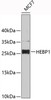Western blot analysis of extracts of MCF-7 cells, using HEBP1 antibody (19-447) .<br/>Secondary antibody: HRP Goat Anti-Rabbit IgG (H+L) at 1:10000 dilution.<br/>Lysates/proteins: 25ug per lane.<br/>Blocking buffer: 3% nonfat dry milk in TBST.