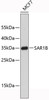 Western blot analysis of extracts of MCF-7 cells, using SAR1B antibody (19-449) .<br/>Secondary antibody: HRP Goat Anti-Rabbit IgG (H+L) at 1:10000 dilution.<br/>Lysates/proteins: 25ug per lane.<br/>Blocking buffer: 3% nonfat dry milk in TBST.