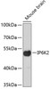 Western blot analysis of extracts of mouse brain, using IP6K2 antibody (19-456) .<br/>Secondary antibody: HRP Goat Anti-Rabbit IgG (H+L) at 1:10000 dilution.<br/>Lysates/proteins: 25ug per lane.<br/>Blocking buffer: 3% nonfat dry milk in TBST.
