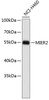 Western blot analysis of extracts of NCI-H460 cells, using MIER2 antibody (19-468) .<br/>Secondary antibody: HRP Goat Anti-Rabbit IgG (H+L) at 1:10000 dilution.<br/>Lysates/proteins: 25ug per lane.<br/>Blocking buffer: 3% nonfat dry milk in TBST.