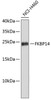 Western blot analysis of extracts of NCI-H460 cells, using FKBP14 antibody (19-476) .<br/>Secondary antibody: HRP Goat Anti-Rabbit IgG (H+L) at 1:10000 dilution.<br/>Lysates/proteins: 25ug per lane.<br/>Blocking buffer: 3% nonfat dry milk in TBST.