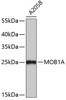 Western blot analysis of extracts of A2058 cells, using MOB1A antibody (19-479) .<br/>Secondary antibody: HRP Goat Anti-Rabbit IgG (H+L) at 1:10000 dilution.<br/>Lysates/proteins: 25ug per lane.<br/>Blocking buffer: 3% nonfat dry milk in TBST.