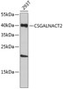 Western blot analysis of extracts of 293T cells, using CSGALNACT2 antibody (19-481) .<br/>Secondary antibody: HRP Goat Anti-Rabbit IgG (H+L) at 1:10000 dilution.<br/>Lysates/proteins: 25ug per lane.<br/>Blocking buffer: 3% nonfat dry milk in TBST.