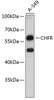 Western blot analysis of extracts of A-549 cells, using CHFR antibody (19-485) .<br/>Secondary antibody: HRP Goat Anti-Rabbit IgG (H+L) at 1:10000 dilution.<br/>Lysates/proteins: 25ug per lane.<br/>Blocking buffer: 3% nonfat dry milk in TBST.