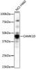 Western blot analysis of extracts of NCI-H460 cells, using CAMK1D antibody (19-492) .<br/>Secondary antibody: HRP Goat Anti-Rabbit IgG (H+L) at 1:10000 dilution.<br/>Lysates/proteins: 25ug per lane.<br/>Blocking buffer: 3% nonfat dry milk in TBST.