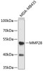 Western blot analysis of extracts of MDA-MB-435 cells, using MMP28 antibody (19-508) .<br/>Secondary antibody: HRP Goat Anti-Rabbit IgG (H+L) at 1:10000 dilution.<br/>Lysates/proteins: 25ug per lane.<br/>Blocking buffer: 3% nonfat dry milk in TBST.