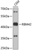 Western blot analysis of extracts of CEM cells, using RBM42 antibody (19-510) .<br/>Secondary antibody: HRP Goat Anti-Rabbit IgG (H+L) at 1:10000 dilution.<br/>Lysates/proteins: 25ug per lane.<br/>Blocking buffer: 3% nonfat dry milk in TBST.
