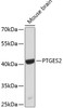 Western blot analysis of extracts of mouse brain, using PTGES2 antibody (19-517) .<br/>Secondary antibody: HRP Goat Anti-Rabbit IgG (H+L) at 1:10000 dilution.<br/>Lysates/proteins: 25ug per lane.<br/>Blocking buffer: 3% nonfat dry milk in TBST.