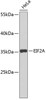 Western blot analysis of extracts of HeLa cells, using EIF2A antibody (19-524) .<br/>Secondary antibody: HRP Goat Anti-Rabbit IgG (H+L) at 1:10000 dilution.<br/>Lysates/proteins: 25ug per lane.<br/>Blocking buffer: 3% nonfat dry milk in TBST.