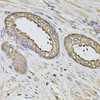 Immunohistochemistry of paraffin-embedded human prostate using S100A12 antibody (19-592) at dilution of 1:100 (40x lens) .