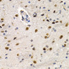 Immunohistochemistry of paraffin-embedded rat brain using ID3 antibody (19-624) at dilution of 1:200 (40x lens) .