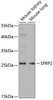 Western blot analysis of extracts of various cell lines, using SFRP2 antibody (19-630) at 1:1000 dilution.<br/>Secondary antibody: HRP Goat Anti-Rabbit IgG (H+L) at 1:10000 dilution.<br/>Lysates/proteins: 25ug per lane.<br/>Blocking buffer: 3% nonfat dry milk in TBST.<br/>Detection: ECL Basic Kit.<br/>Exposure time: 90s.