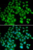 Immunofluorescence analysis of HeLa cells using TMSB4X antibody (19-661) . Blue: DAPI for nuclear staining.