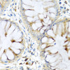 Immunohistochemistry of paraffin-embedded human colon using PI3 antibody (19-664) at dilution of 1:100 (40x lens) .