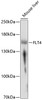 Western blot analysis of extracts of mouse liver, using FLT4 antibody (19-753) at 1:1000 dilution.<br/>Secondary antibody: HRP Goat Anti-Rabbit IgG (H+L) at 1:10000 dilution.<br/>Lysates/proteins: 25ug per lane.<br/>Blocking buffer: 3% nonfat dry milk in TBST.<br/>Detection: ECL Enhanced Kit.<br/>Exposure time: 30s.