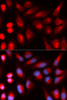 Immunofluorescence analysis of U2OS cells using DCLRE1C antibody (19-757) . Blue: DAPI for nuclear staining.