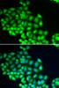 Immunofluorescence analysis of HeLa cells using ERCC2 antibody (19-771) . Blue: DAPI for nuclear staining.