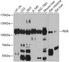 Western blot analysis of extracts of various cell lines, using PIGR antibody (22-020) at 1:1000 dilution.<br/>Secondary antibody: HRP Goat Anti-Rabbit IgG (H+L) at 1:10000 dilution.<br/>Lysates/proteins: 25ug per lane.<br/>Blocking buffer: 3% nonfat dry milk in TBST.<br/>Detection: ECL Basic Kit.<br/>Exposure time: 90s.