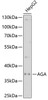 Western blot analysis of extracts of HepG2 cells, using AGA antibody (22-149) at 1:1000 dilution.<br/>Secondary antibody: HRP Goat Anti-Rabbit IgG (H+L) at 1:10000 dilution.<br/>Lysates/proteins: 25ug per lane.<br/>Blocking buffer: 3% nonfat dry milk in TBST.<br/>Detection: ECL Basic Kit.<br/>Exposure time: 30s.