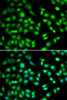 Immunofluorescence analysis of HeLa cells using CDKN2D antibody (22-309) . Blue: DAPI for nuclear staining.
