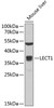 Western blot analysis of extracts of mouse liver, using LECT1 antibody (22-375) at 1:1000 dilution.<br/>Secondary antibody: HRP Goat Anti-Rabbit IgG (H+L) at 1:10000 dilution.<br/>Lysates/proteins: 25ug per lane.<br/>Blocking buffer: 3% nonfat dry milk in TBST.<br/>Detection: ECL Basic Kit.<br/>Exposure time: 30s.