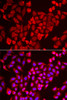 Immunofluorescence analysis of U2OS cells using TNP2 antibody (22-475) . Blue: DAPI for nuclear staining.