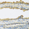 Immunohistochemistry of paraffin-embedded human prostate using TSHB antibody (22-480) at dilution of 1:100 (40x lens) .