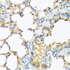 Immunohistochemistry of paraffin-embedded mouse lung using TSHB antibody (22-480) at dilution of 1:100 (40x lens) .