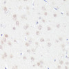 Immunohistochemistry of paraffin-embedded rat brain using BCL9 antibody (22-491) at dilution of 1:100 (40x lens) .