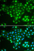 Immunofluorescence analysis of HeLa cells using ABCA3 antibody (22-511) . Blue: DAPI for nuclear staining.