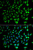 Immunofluorescence analysis of HeLa cells using SLC25A20 antibody (22-526) . Blue: DAPI for nuclear staining.
